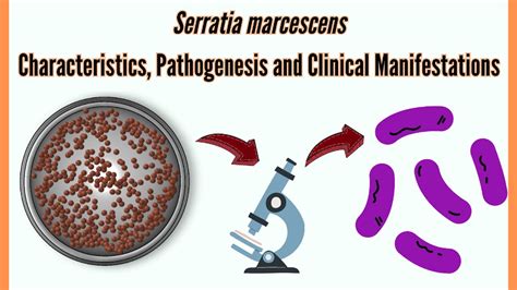serratia sauce|Serratia: Background, Pathophysiology, Epidemiology .